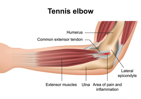 Anatomie du coude de tennis