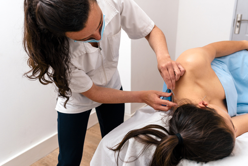 médecin effectuant une thérapie à l'aiguille sèche sur un patient